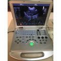 Upgraded Version Laptop Color Doppler Ultrasound Machine